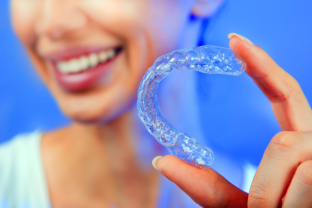 Como funciona o Invisalign? conheça os alinhadores transparentes! -  Dentista Tatuapé