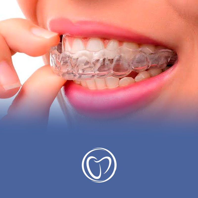 invisalign